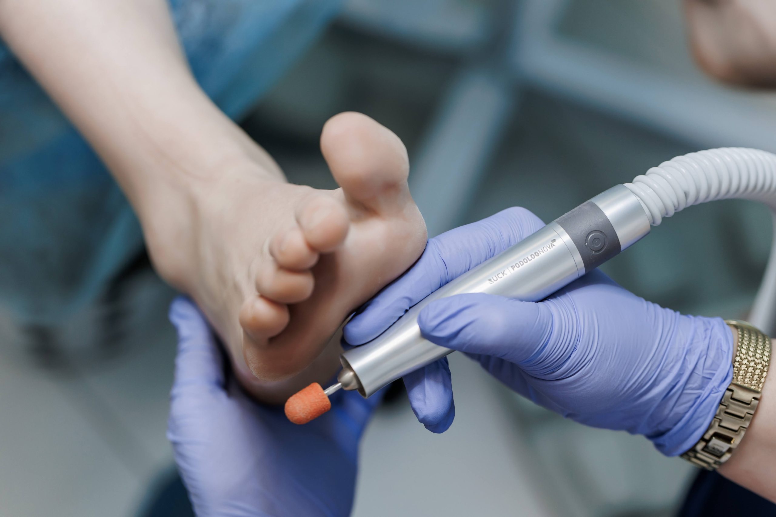 Подологічна обробка стоп