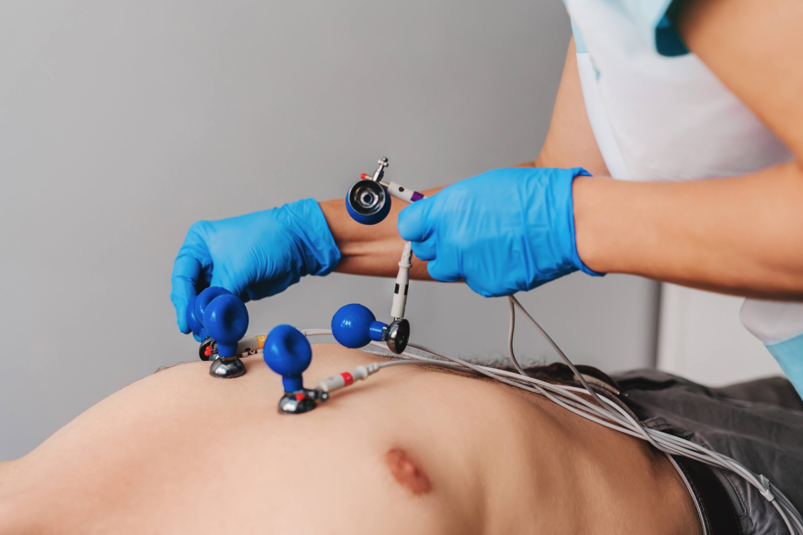 ЛІкар-кардіолог накладає електроди для проведення екг