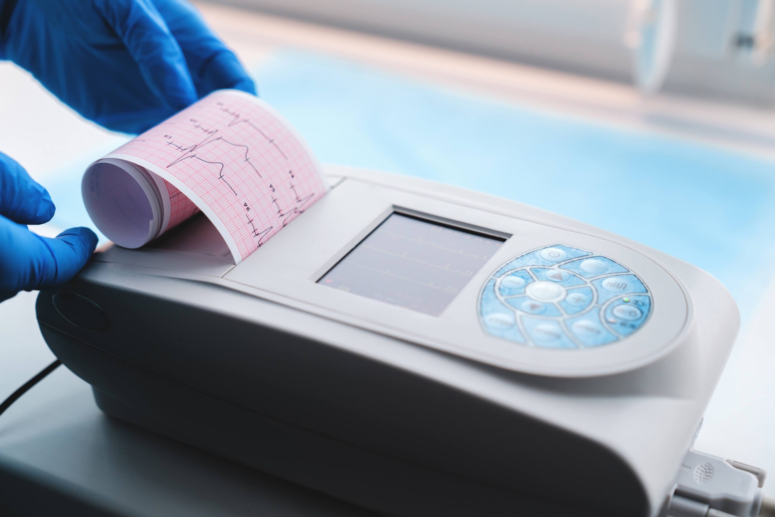 Обстеження серця за допомогою електрокардіограми