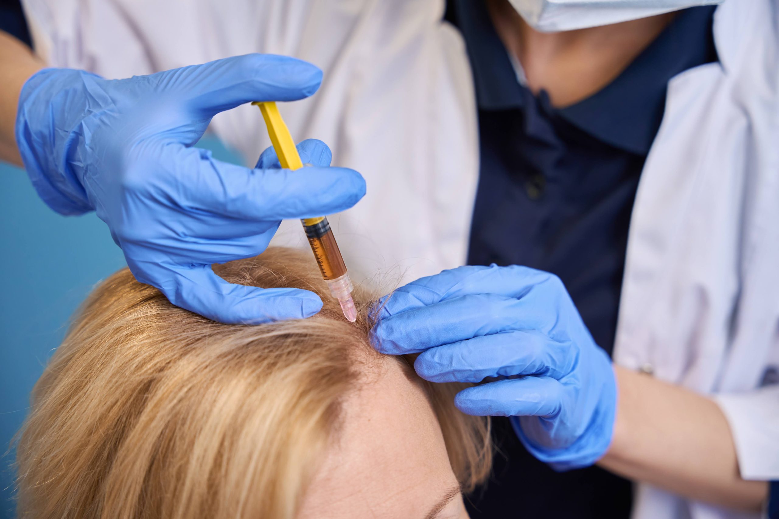Трихолог проводить мезотерапію шкіри голови